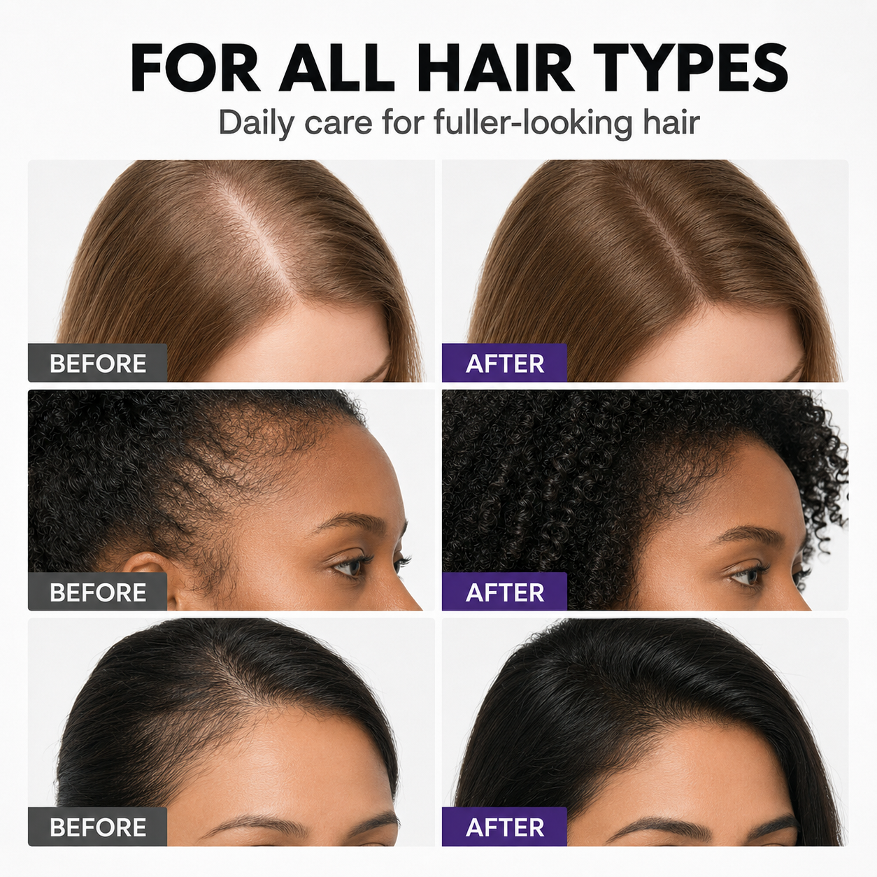 For Hair That Feels Thin, Damaged, Or Stuck At The Same Length