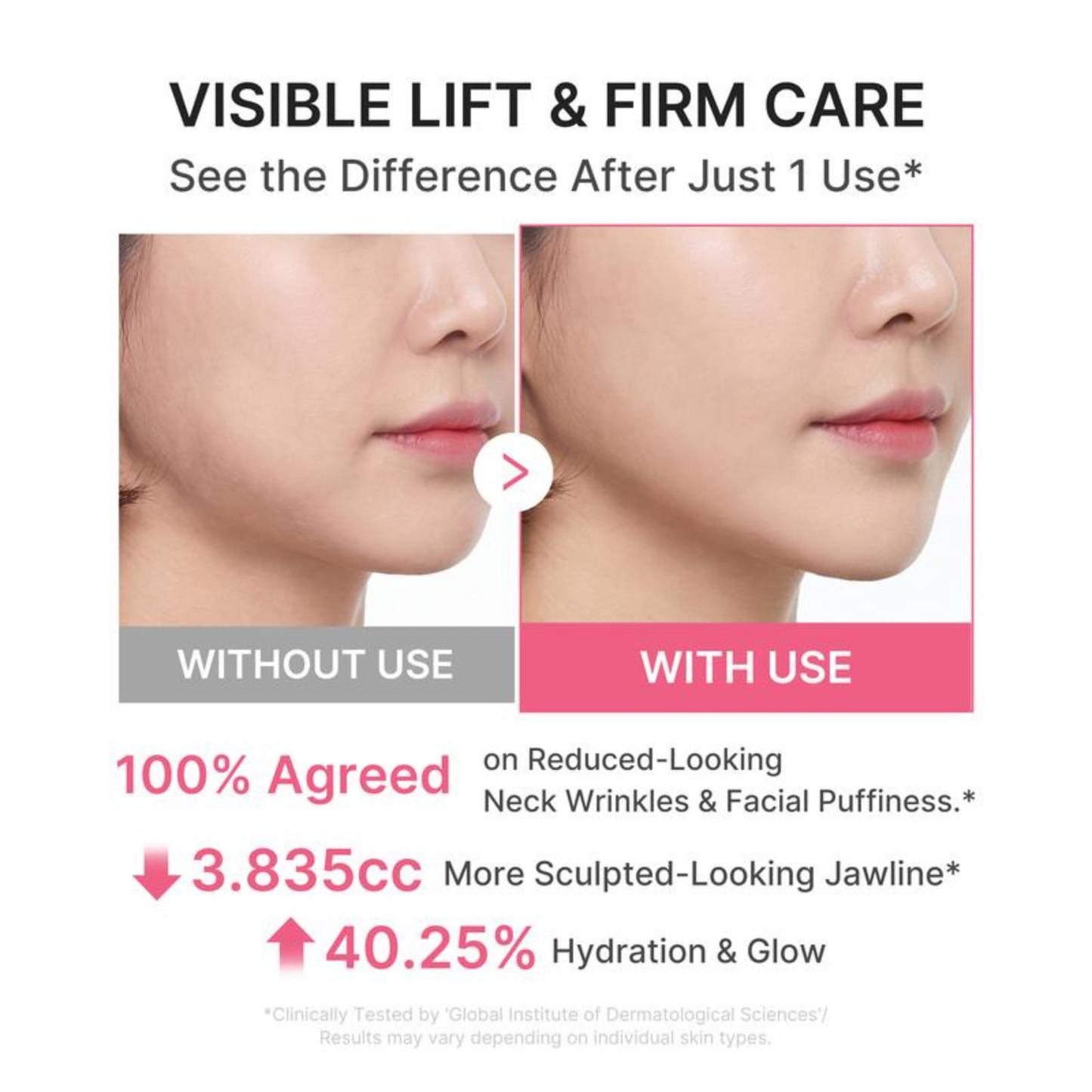 PDRN Collagen Gua Sha for Saggy Necks, Jawline & Wrinkles