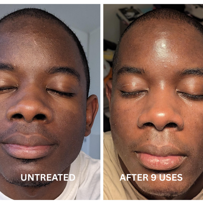 Pure Vitamin C + Glutathione Booster Shot For Melanin Skin