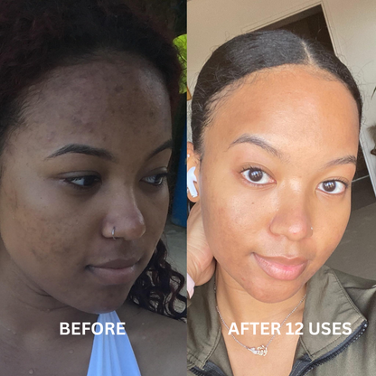 Pure Vitamin C + Glutathione Booster Shot For Melanin Skin