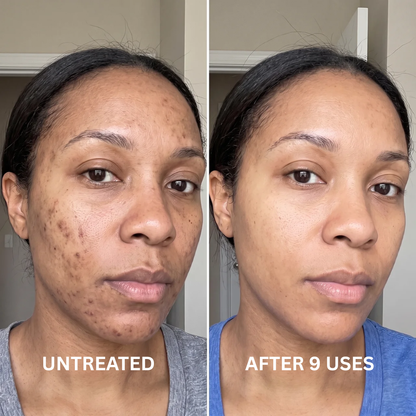 Pure Vitamin C + Glutathione Booster Shot For Melanin Skin
