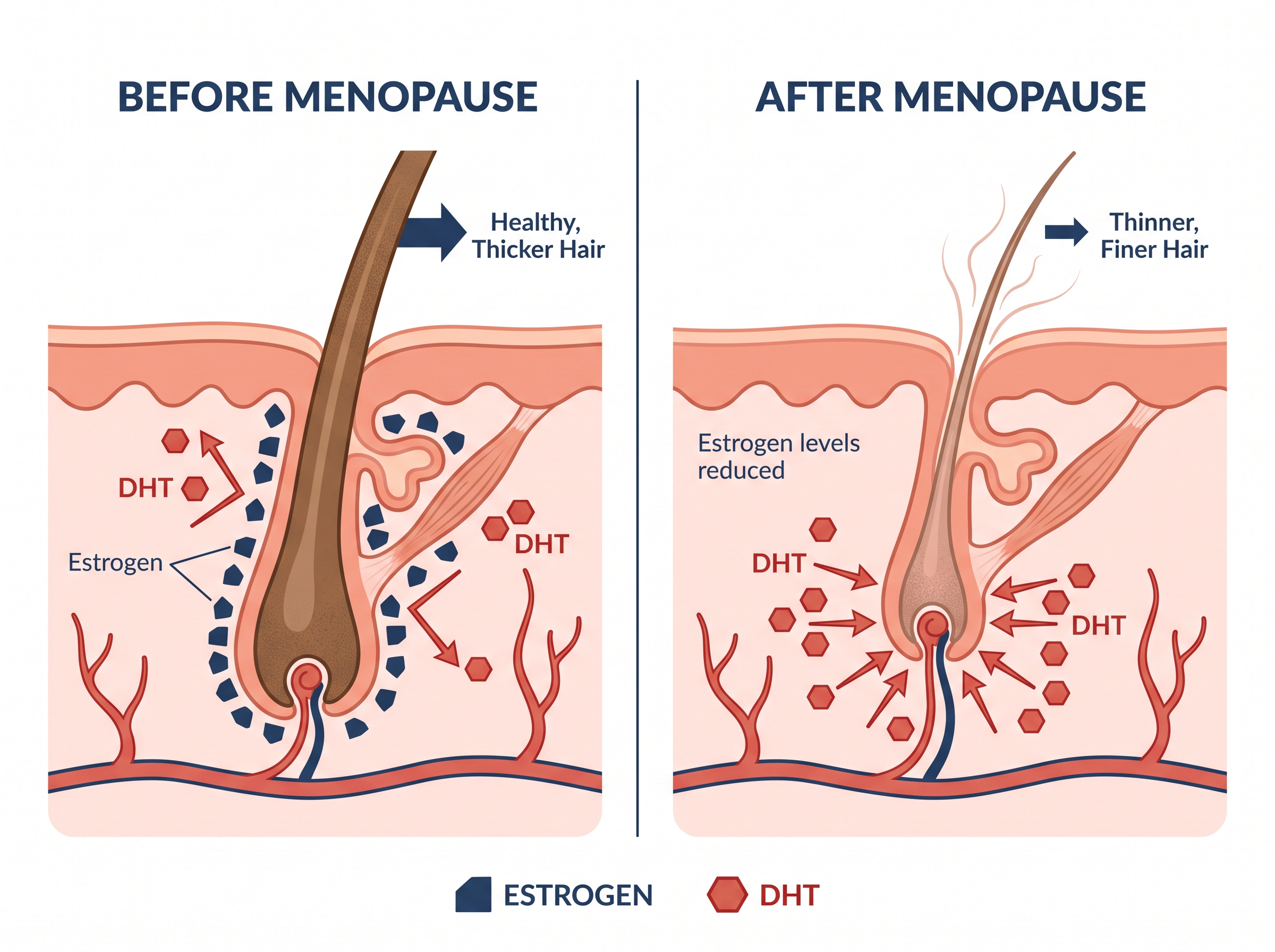DHT follicle diagram