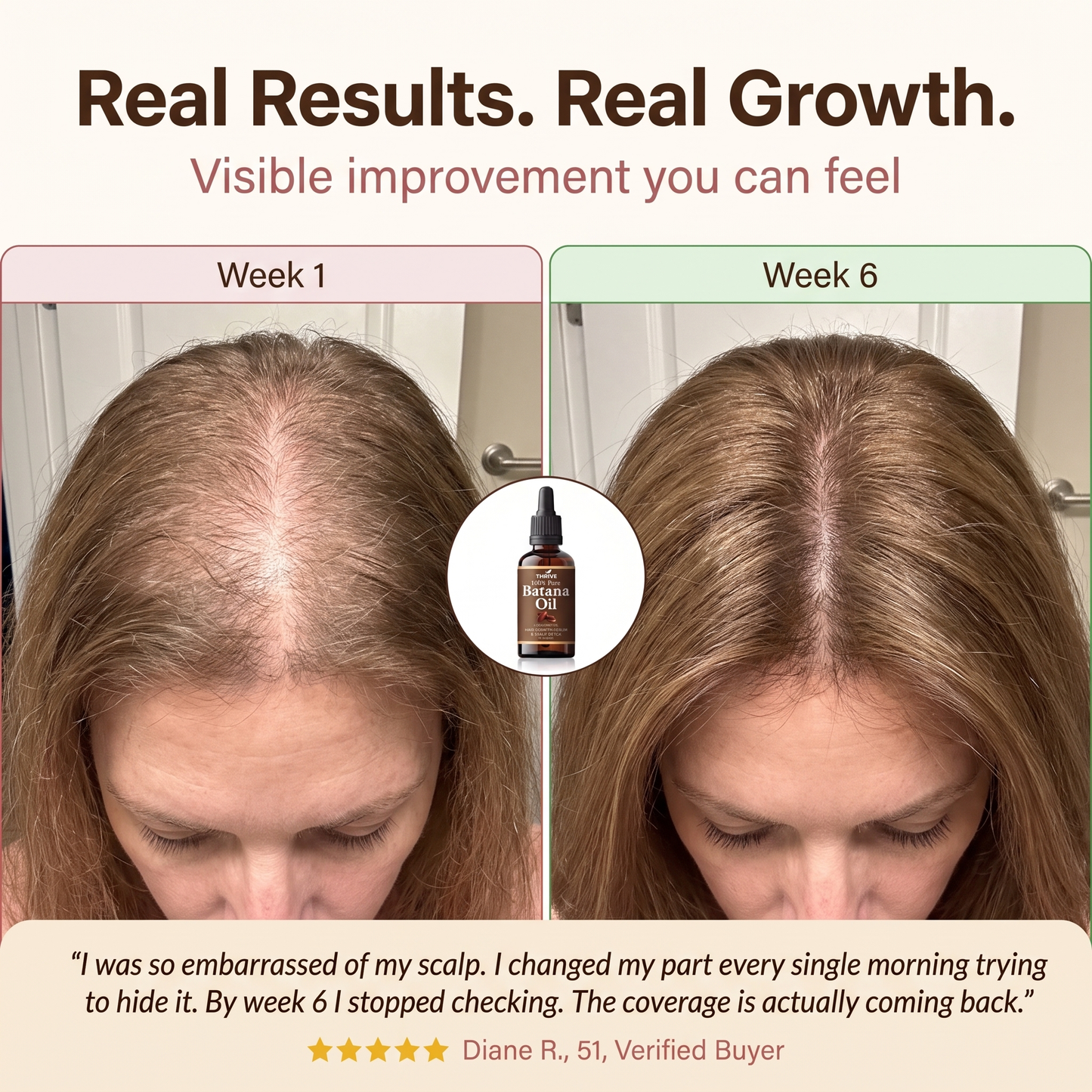 Stop Postponing Your Next Chapter Because Of Your Hair - Restore Visible Fullness In Just Weeks