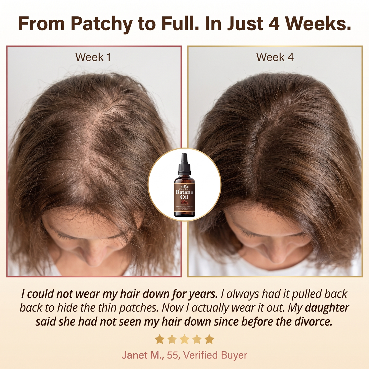 Stop Postponing Your Next Chapter Because Of Your Hair - Restore Visible Fullness In Just Weeks