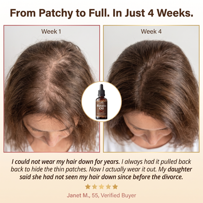 Stop Postponing Your Next Chapter Because Of Your Hair - Restore Visible Fullness In Just Weeks