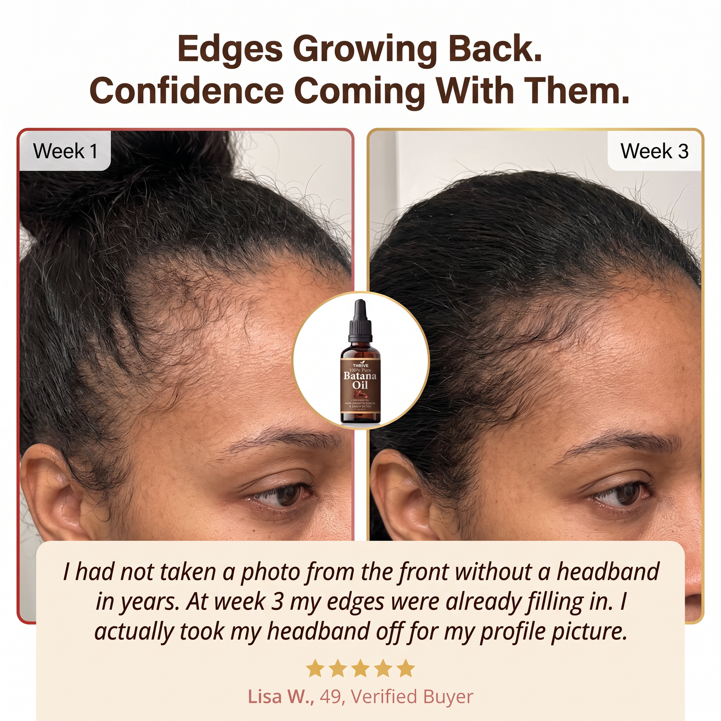 Stop Postponing Your Next Chapter Because Of Your Hair - Restore Visible Fullness In Just Weeks