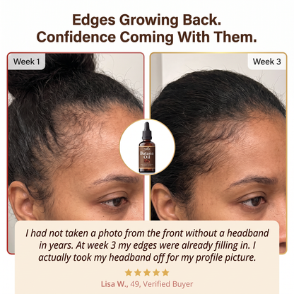 Stop Postponing Your Next Chapter Because Of Your Hair - Restore Visible Fullness In Just Weeks
